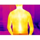 Aplicatii camere termografice in Medicina 